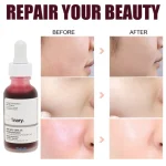 سرم لایه بردار پیلینگ سلوشن AHA و BHA اوردینری - تصویر 4